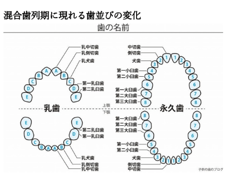 小学生のマウスピース型カスタムメイド矯正装置（インビザライン